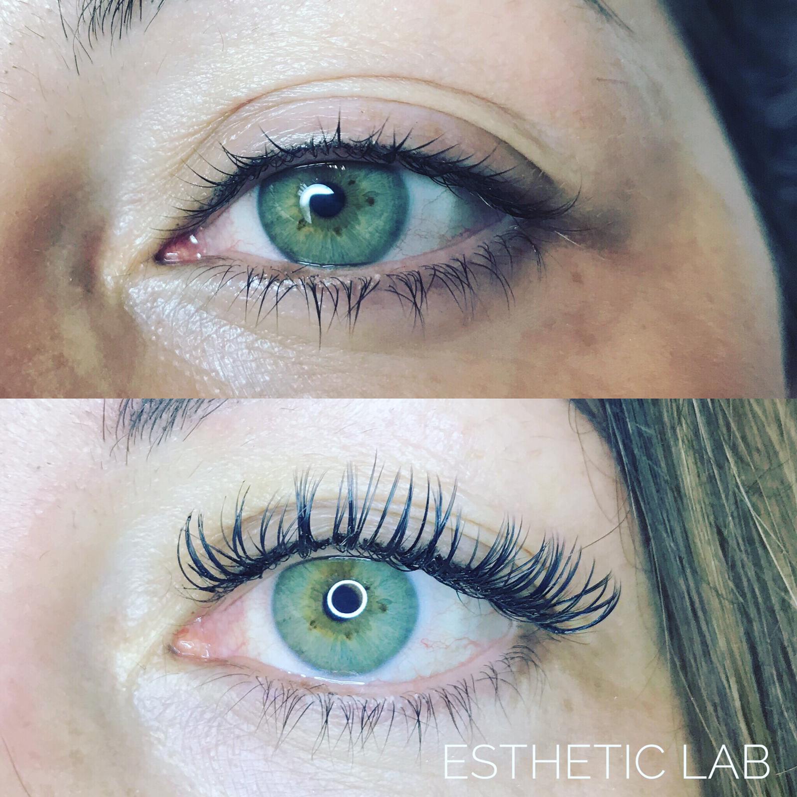 Trattamenti Estetici A Barbisano Estheticlab Barbisano Trattamenti Estetici A Barbisano Estheticlab Barbisano