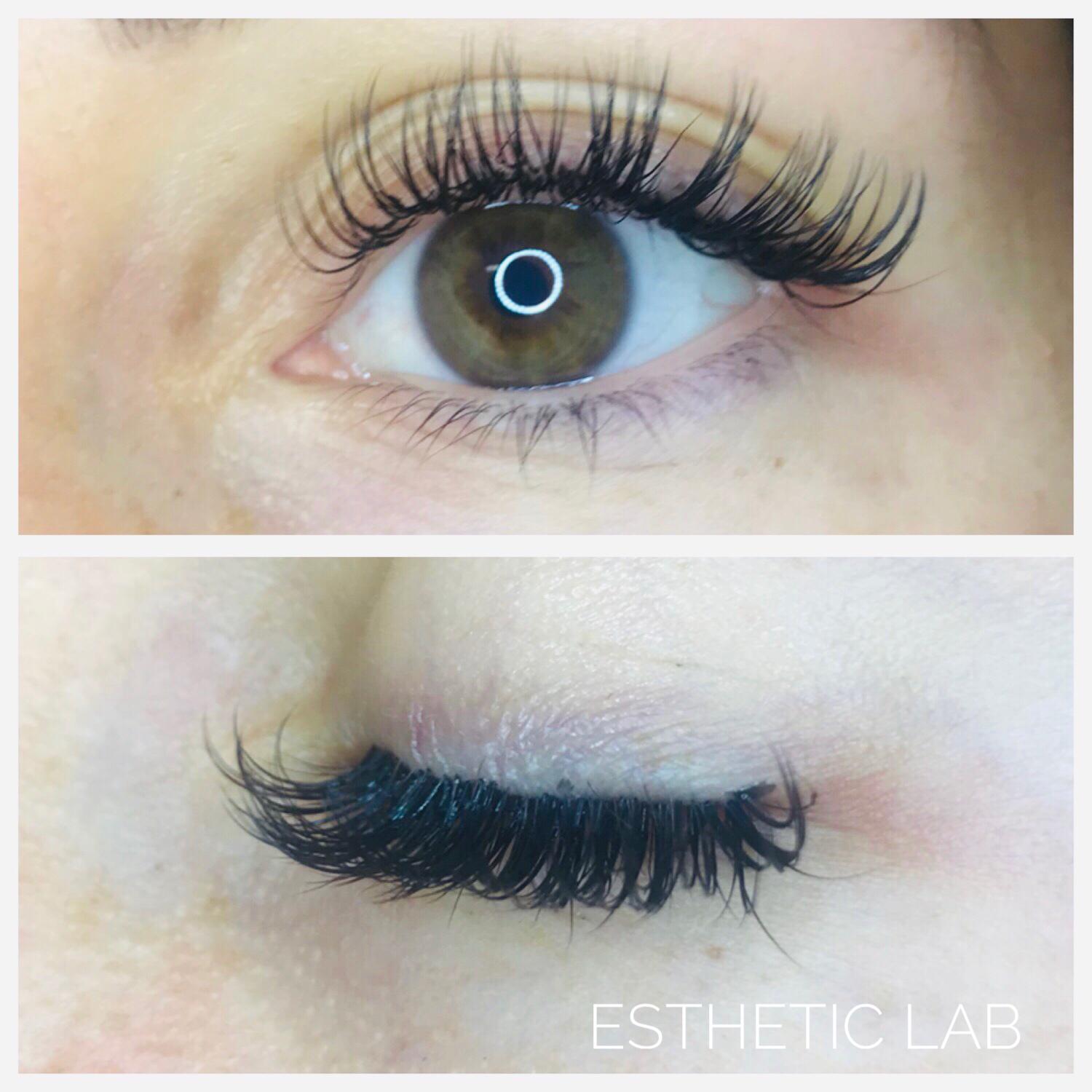 Trattamenti Estetici A Barbisano Estheticlab Barbisano Trattamenti Estetici A Barbisano Estheticlab Barbisano