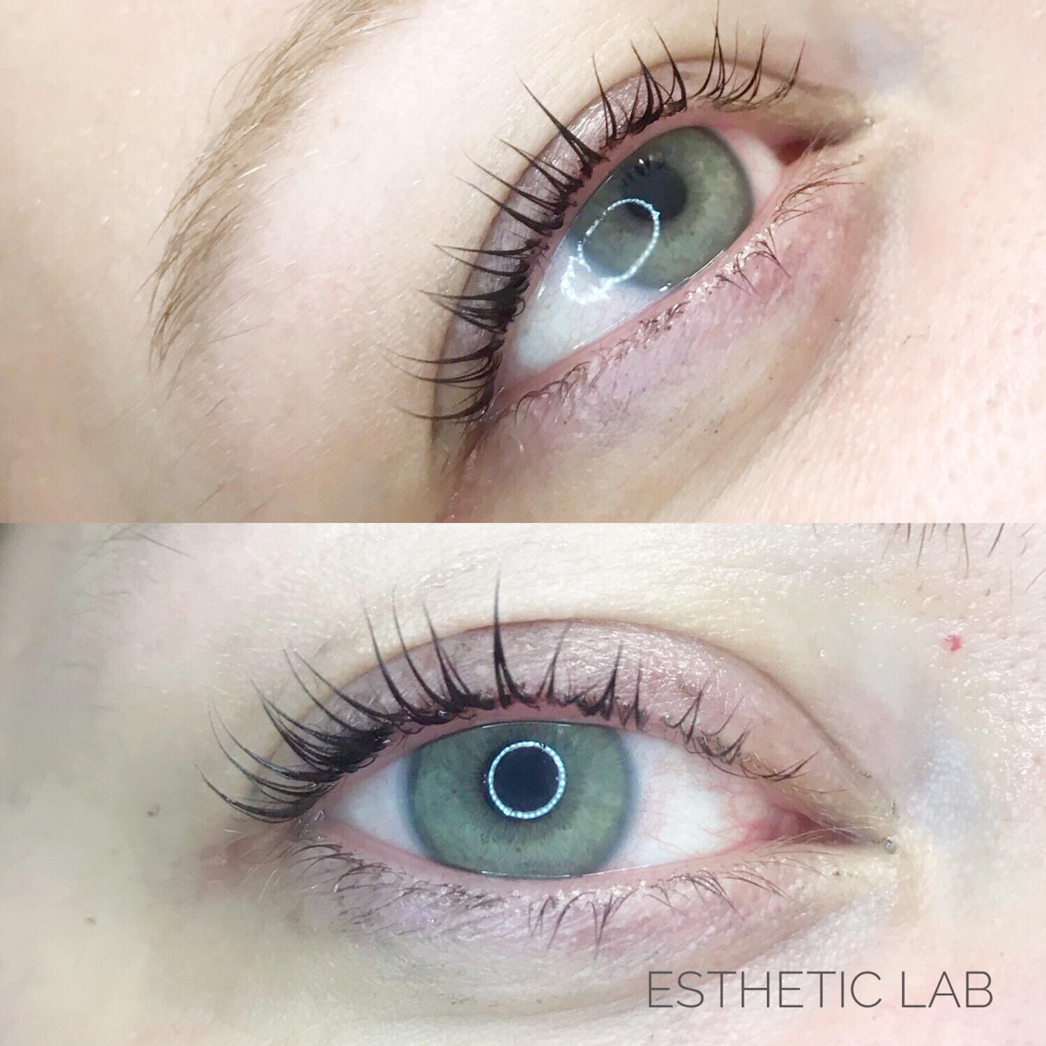 Trattamenti Estetici A Barbisano Estheticlab Barbisano Trattamenti Estetici A Barbisano Estheticlab Barbisano